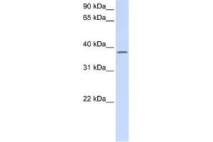 C21ORF91 antibody used at 1 ug/ml to detect target protein. (C21orf91 Antikörper  (Middle Region))