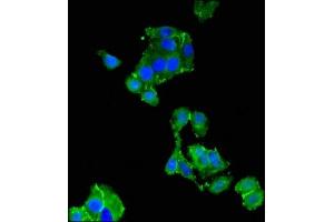 Immunofluorescent analysis of HepG2 cells using ABIN7173569 at dilution of 1:100 and Alexa Fluor 488-congugated AffiniPure Goat Anti-Rabbit IgG(H+L) (TNNC1 Antikörper  (AA 11-149))