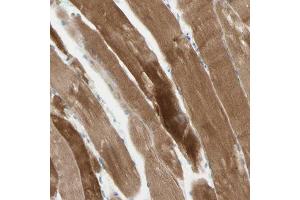 Immunohistochemical staining (Formalin-fixed paraffin-embedded sections) of human skeletal muscle with JPH1 polyclonal antibody  shows strong cytoplasmic positivity in myocytes. (Junctophilin 1 Antikörper  (AA 387-512))