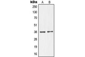 Western blot analysis of NKX2-1 expression in MAD109 (A), HeLa (B), SP2/0 (C) whole cell lysates. (NKX2-1 Antikörper  (N-Term))