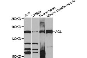 Western blot analysis of extracts of various cell lines, using AGL antibody (ABIN4902856) at 1:1000 dilution. (AGL Antikörper)
