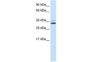 WB Suggested Anti-SFRP1 Antibody Titration:  0. (SFRP1 Antikörper  (Middle Region))