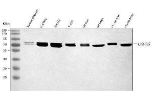 Western blot analysis of GRP78/BIP/HSPA5 using anti-GRP78/BIP/HSPA5 antibody (ABIN7602452).