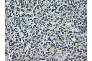 Immunohistochemical staining of paraffin-embedded Ovary tissue using anti-NEK6mouse monoclonal antibody. (NEK6 Antikörper)