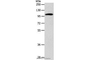 Western blot analysis of 293T cell, using ADCY1 Polyclonal Antibody at dilution of 1:1000 (ADCY1 Antikörper)