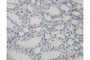 Immunohistochemical staining of formalin-fixed paraffin-embedded human kidney tissue showing cytoplasmic and nuclear staining with PAWR polyclonal antibody  at 1 : 100 dilution. (PAWR Antikörper  (C-Term))