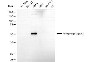 Western blotting analysis using phospho-p53 (S33) antibody (ABIN7800680).