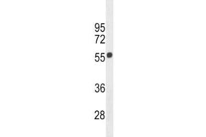 Cannabinoid Receptor 1 antibody western blot analysis in 293 lysate. (CNR1 Antikörper  (AA 161-187))