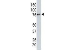 Anti-HA tag antibody testing a tagged recombinant protein. (HA-Tag Antikörper)