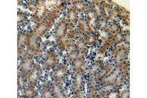 Used in DAB staining on fromalin fixed paraffin- embedded kidney tissue (CGA Antikörper  (AA 25-120))