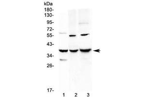 Western blot testing of 1) rat liver, 2) mouse Neuro-2a and 3) mouse HEPA1-6 lysate with IGFBP2 antibody at 0.