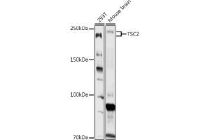 Western blot analysis of extracts of various cell lines, using TSC2 antibody (ABIN1683176, ABIN5663676 and ABIN7101314) at 1:1000 dilution. (Tuberin Antikörper)