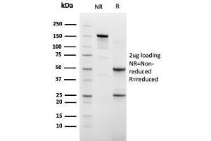 SDS-PAGE Analysis of Purified Cadherin 16 Mouse Monoclonal Antibody (CDH16/2448).