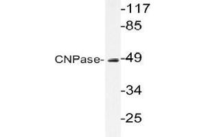 Western blot (WB) analysis of CNPase antibody in extracts from HUVEC cells. (Cnpase Antikörper)