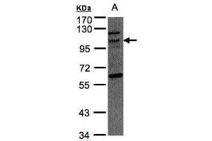 WB Image Sample(30 μg of whole cell lysate) A:Raji, 7. (TAO Kinase 3 Antikörper)