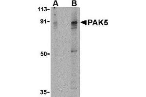 Western Blotting (WB) image for anti-P21 Protein (Cdc42/Rac)-Activated Kinase 7 (PAK7) (Middle Region) antibody (ABIN1031031) (PAK7 Antikörper  (Middle Region))