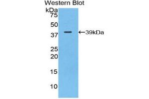 Western blot analysis of the recombinant protein. (C3 Antikörper  (AA 966-1313))