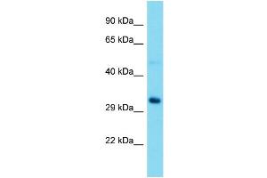Western Blotting (WB) image for anti-Ribosomal RNA Processing 15 Homolog (RRP15) (Middle Region) antibody (ABIN2774509) (RRP15 Antikörper  (Middle Region))