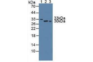 Western blot analysis of (1) Human Serum, (2) Human Lung Tissue and (3) Human A549 Cells. (FKBP7 Antikörper  (AA 24-217))