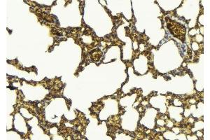 Immunohistochemistry (IHC) image for anti-Natural Killer Cell Receptor 2B4 (CD244) (N-Term) antibody (ABIN6260596)