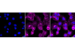 Immunocytochemical staining of HT- cells with Neuropilin 1 antibody (ABIN7799586), 1:1,000). (Rekombinanter Neuropilin 1 Antikörper)