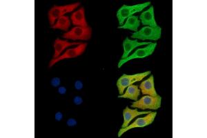 ABIN7097043 and ABIN7101110 staining Hela cells by IF/ICC.