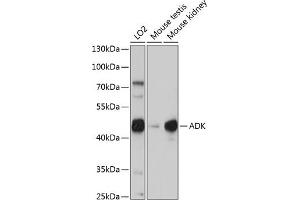 Western blot analysis of extracts of various cell lines, using ADK antibody (ABIN7265463) at 1:1000 dilution. (ADK Antikörper  (AA 200-345))