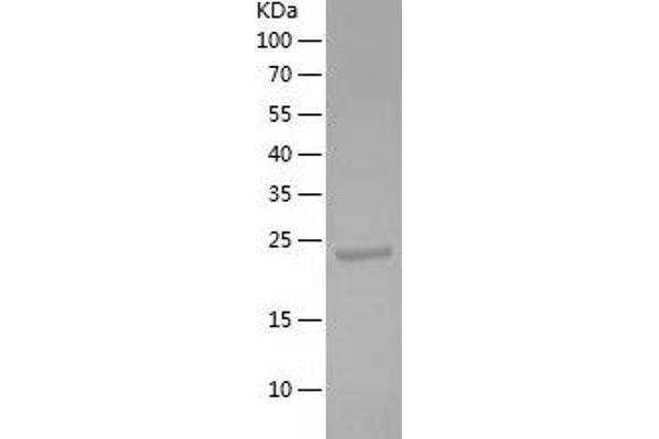 Cytokeratin 1 Protein (AA 487-644) (His-IF2DI Tag)