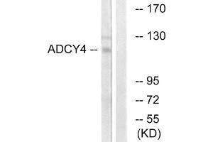 Western blot analysis of extracts from Jurkat cells, using ADCY4 antibody. (ADCY4 Antikörper  (Internal Region))