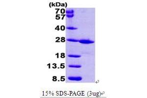SDS-PAGE (SDS) image for FK506 Binding Protein 14, 22 KDa (FKBP14) (AA 20-211) protein (His tag) (ABIN667027) (FKBP14 Protein (AA 20-211) (His tag))