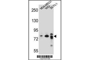 Western blot analysis in MDA-MB231,WiDr,ZR-75-1 cell line lysates (35ug/lane). (ARHGAP22 Antikörper  (C-Term))