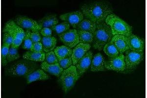 IF analysis of ADORA2B using anti-ADORA2B antibody (ABIN7600066).