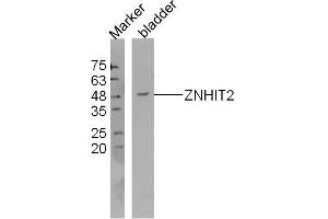 Mouse bladder lysates probed with ZNHIT2 Polyclonal Antibody, Unconjugated  at 1:300 dilution and 4˚C overnight incubation. (ZNHIT2 Antikörper  (AA 51-150))