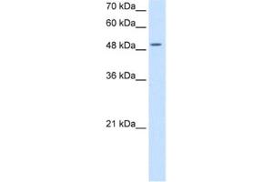 Western Blotting (WB) image for anti-Eukaryotic Translation Initiation Factor 2, Subunit 3 Gamma, 52kDa (EIF2S3) antibody (ABIN2462926)