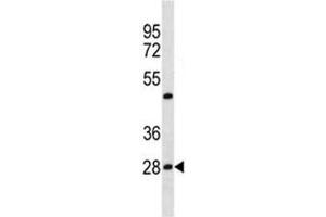 Western Blotting (WB) image for anti-Prohibitin (PHB) (AA 92-121) antibody (ABIN3032314)