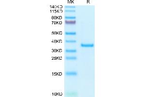 Human SFRP2 on Tris-Bis PAGE under reduced condition. (SFRP2 Protein (AA 25-295) (His tag))