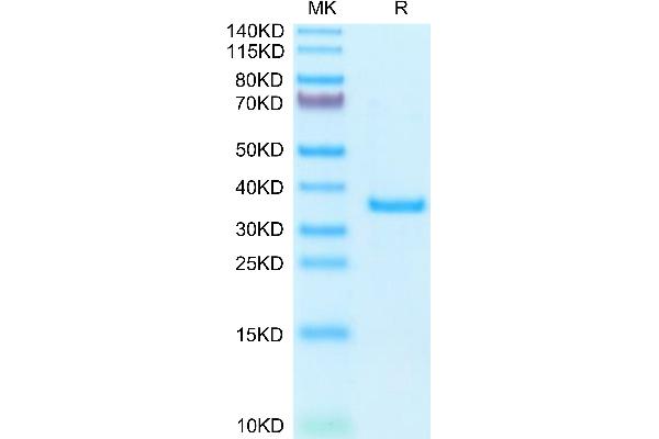SFRP2 Protein (AA 25-295) (His tag)
