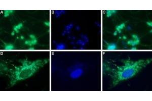 Expression of neuropeptide Y4 receptor in rat DRG - Immunocytochemical staining of a primary culture of rat dorsal root ganglion (DRG) neurons. (NPY4R Antikörper  (Intracellular))