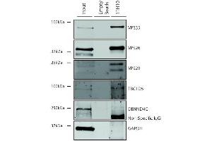 Immunoprecipitation analysis using Mouse Anti-VPS35 Monoclonal Antibody, Clone 11H10 (ABIN6933006). (VPS35 Antikörper  (Atto 488))