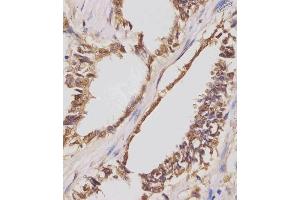 Immunohistochemistry (Paraffin-embedded Sections) (IHC (p)) image for anti-Insulin-Like Growth Factor 2 mRNA Binding Protein 1 (IGF2BP1) (AA 508-534), (C-Term) antibody (ABIN654423)