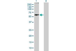 Western Blot analysis of ABCC11 expression in transfected 293T cell line by ABCC11 MaxPab polyclonal antibody. (ABCC11 Antikörper  (AA 1-553))