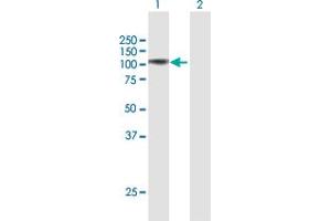 Western Blot analysis of FAP expression in transfected 293T cell line by FAP MaxPab polyclonal antibody. (FAP Antikörper  (AA 1-760))