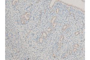 Immunohistochemistry (IHC) image for anti-Microphthalmia-Associated Transcription Factor (MITF) (pSer180), (pSer73) antibody (ABIN6255037)