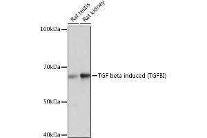 Western blot analysis of extracts of various cell lines, using TGF beta induced TGF beta induced (TGFBI) Rabbit mAb (ABIN7270915) at 1:1000 dilution. (TGFBI Antikörper)