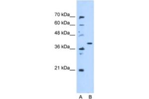 Western Blotting (WB) image for anti-Enoyl CoA Hydratase Domain Containing 3 (ECHDC3) antibody (ABIN2463233) (ECHDC3 Antikörper)