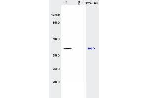 L1 rat kidney lysates L2 rat brain lysates probed with Anti CTHRC1 Polyclonal Antibody, Unconjugated  at 1:200 in 4˚C. (CTHRC1 Antikörper  (AA 31-130))