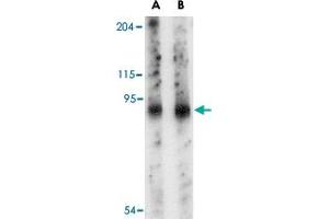 Western blot analysis of SLITRK6 in mouse lung tissue lysate with SLITRK6 polyclonal antibody  at (A) 0. (SLITRK6 Antikörper  (Internal Region))