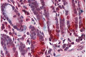 Human Small Intestine (formalin-fixed, paraffin-embedded) stained with NOD2 antibody ABIN351443 at 3 ug/ml followed by biotinylated goat anti-rabbit IgG secondary antibody ABIN481713, alkaline phosphatase-streptavidin and chromogen. (NOD2 Antikörper  (N-Term))