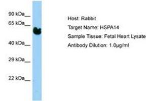 Image no. 1 for anti-Heat Shock 70kDa Protein 14 (HSPA14) (AA 37-86) antibody (ABIN6750192) (HSPA14 Antikörper  (AA 37-86))