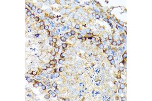 Immunohistochemistry of paraffin-embedded mouse testis using eIF2A Rabbit mAb (ABIN7267035) at dilution of 1:100 (40x lens). (EIF2A Antikörper)
